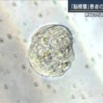 “Muse細胞”脳梗塞患者の身体機能が改善(2021年5月18日)