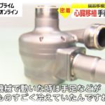 臓器移植法 施行25年　心臓移植 手術後の生活は