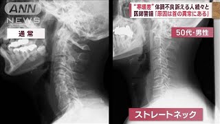 “寒暖差”体調不良　訴える人続々と　医師警鐘「原因は首の異常にある」　(2023年5月23日)