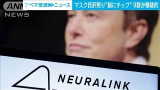 イーロン・マスク氏の“脳埋め込みチップ”「利用したい」は5％(2024年2月7日)
