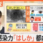 妊婦は特に注意が必要 “はしか”感染相次ぐ　最強の「感染力」･･･あなたはワクチンを打ったことある？【Nスタ解説】｜TBS NEWS DIG